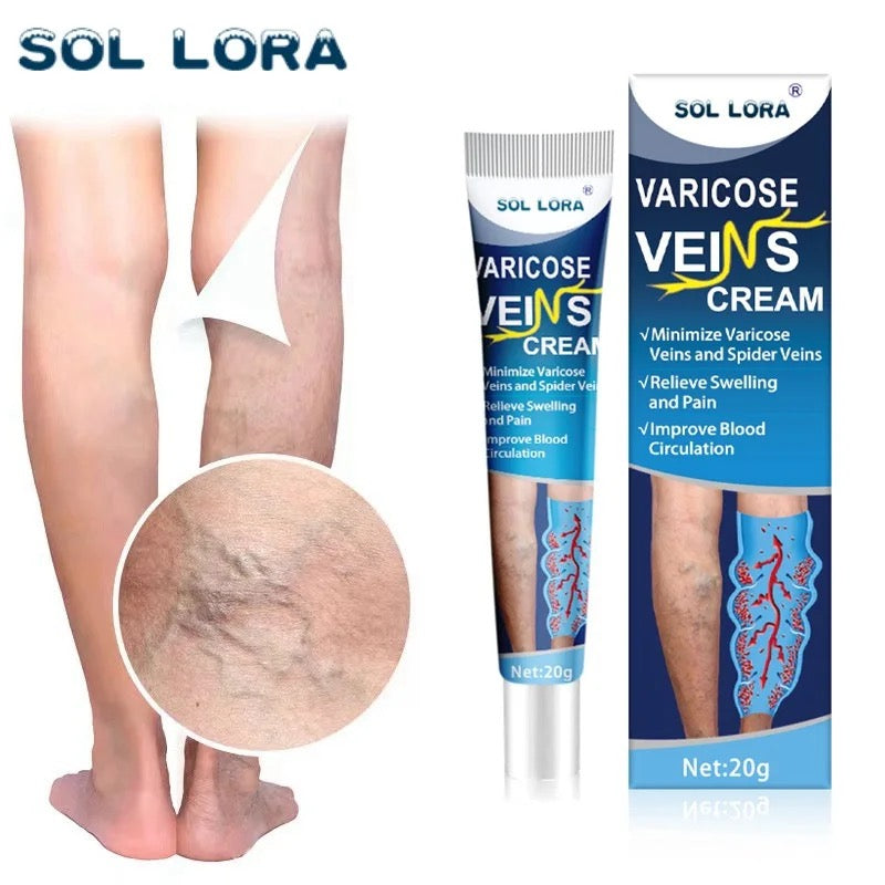 Varicose veins Heal Cream®