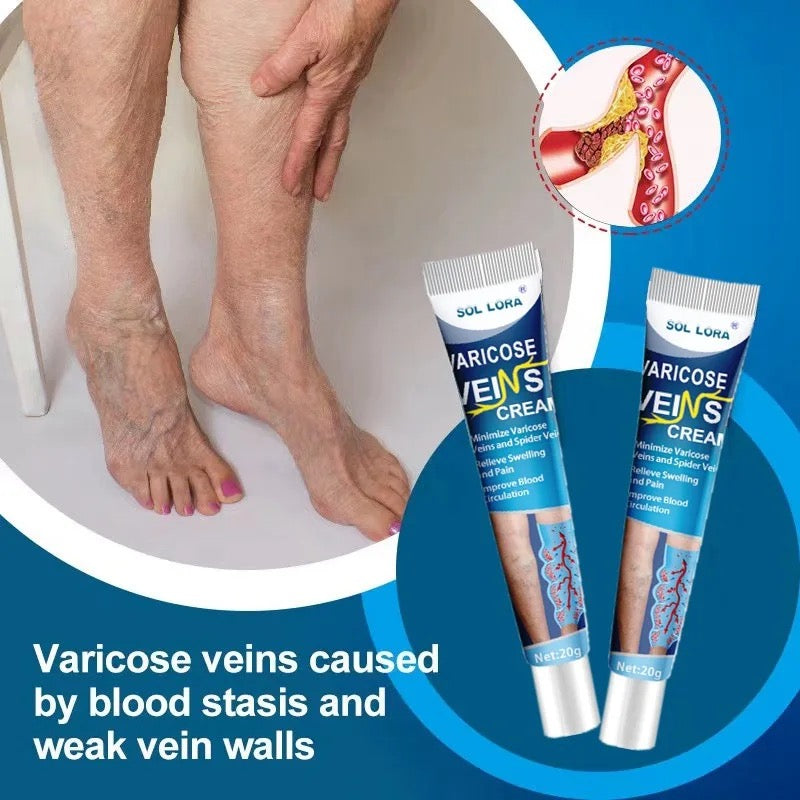 Varicose veins Heal Cream®