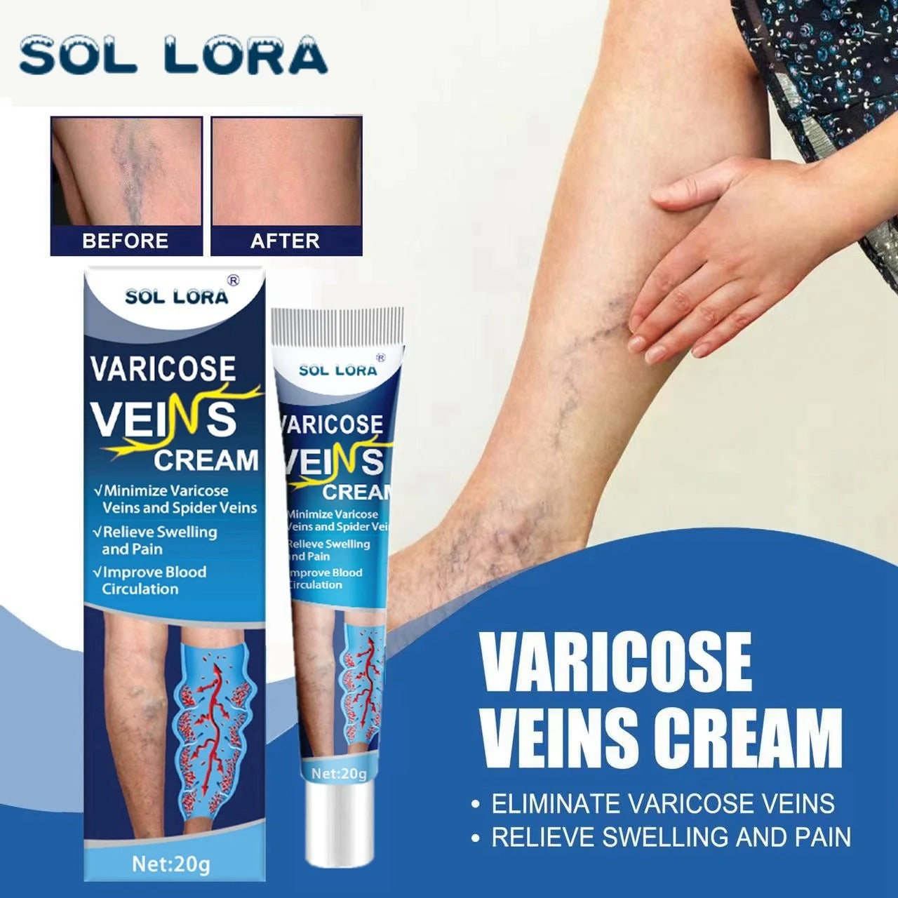 Varicose veins Heal Cream®